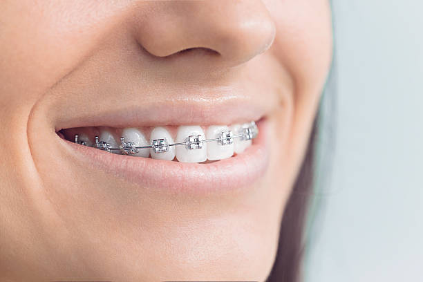 Best Dental Fillings (Composite and Amalgam)  in West Linn, OR